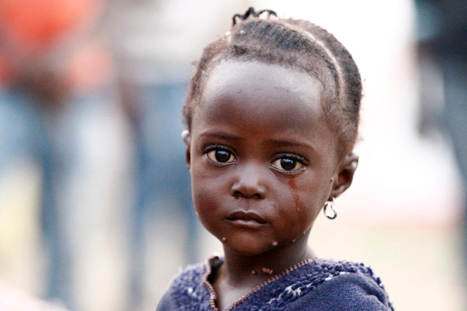 Congolese refugee child