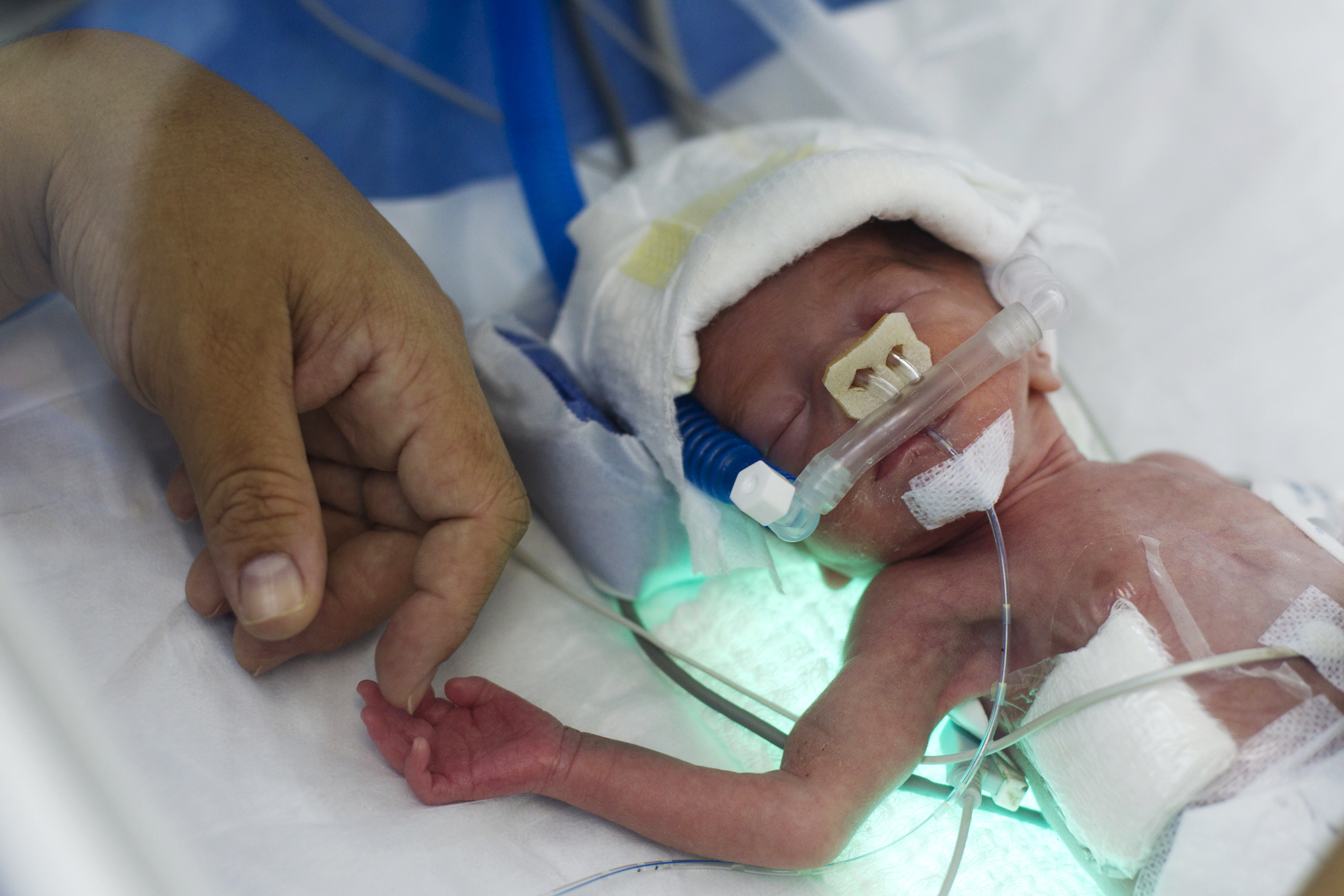 https://www.brookings.edu/wp-content/uploads/2016/06/premature-baby.jpg