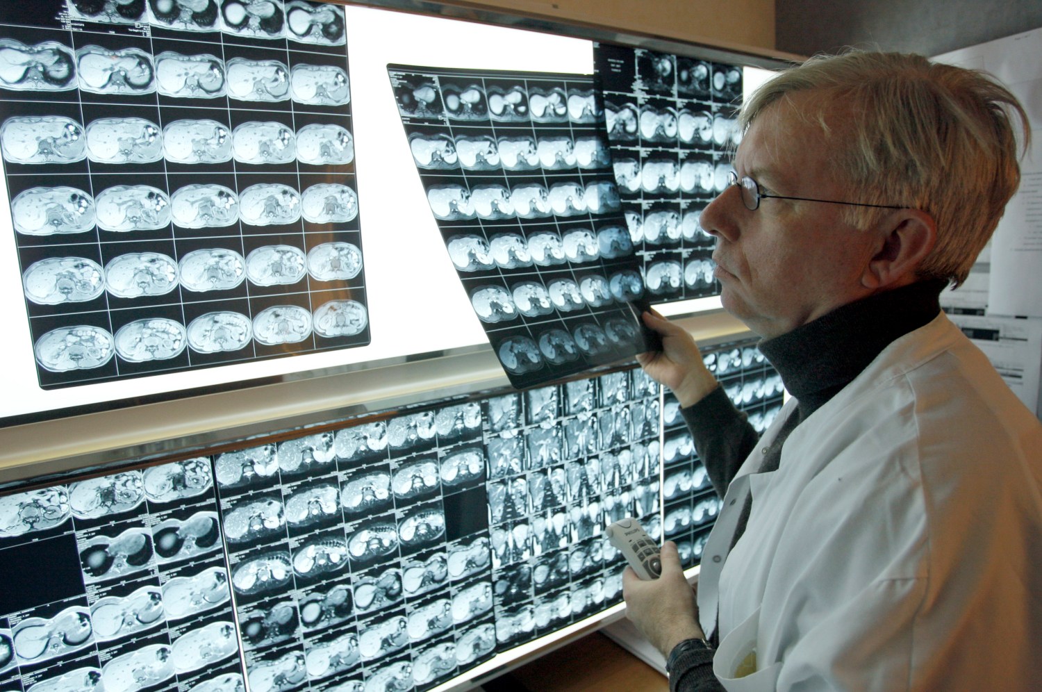 A radiologist examines X-rays of a patient at the Ambroise Pare hospital in Marseille, southern France, April 8, 2008.   REUTERS/Jean-Paul Pelissier (FRANCE) - PM1E4480UAL01