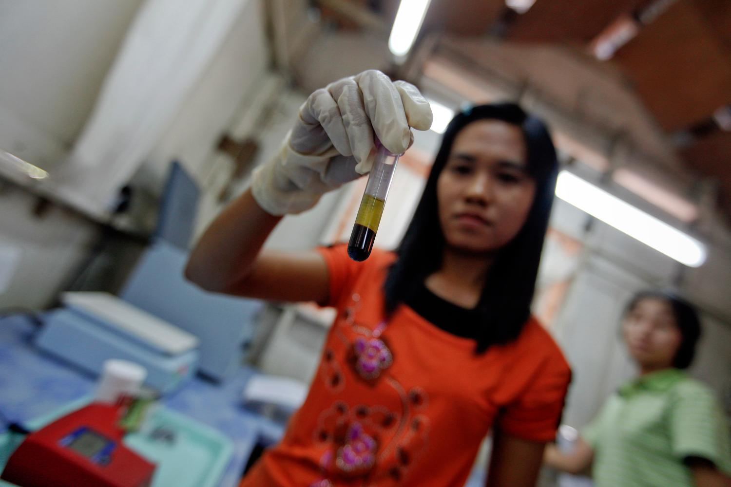 A lab worker holds up a test-tube of blood before conducting HIV tests at Medecins Sans Frontieres-Holland (AZG)'s clinic in Yangon February 21, 2012. Tens of thousands of lives are at risk in Myanmar due to an anticipated funding shortfall to treat people living with HIV and tuberculosis, medical charity Medecins Sans Frontieres (MSF) warned Wednesday, urging international donors to provide immediate support to the impoverished country. Myanmar is already facing "a devastating gap" between people's needs and access to treatment and a decision by the Global Fund to fight AIDS, Tuberculosis and Malaria to cancel funding for 2013 because of a lack of donor money could worsen the situation, the report "Lives in the balance: the urgent need for HIV and TB treatment in Myanmar" said. Picture taken February 21, 2012.   REUTERS/Soe Zeya Tun (MYANMAR - Tags: SOCIETY HEALTH) - GM1E82M0ZJO01