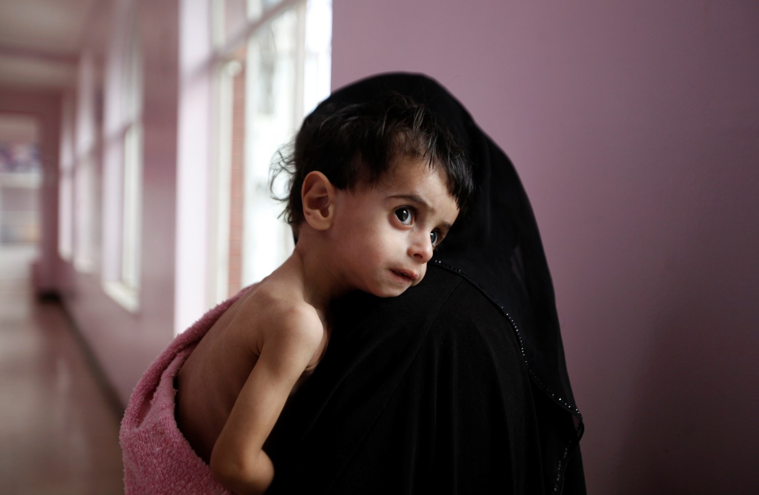 A woman holds her malnourished boy after he was weighed at a hospital malnutrition intensive care unit in Sanaa, Yemen September 27, 2016. REUTERS/Khaled Abdullah   TPX IMAGES OF THE DAY    SEARCH "FAMINE YEMEN" FOR THIS STORY. SEARCH "WIDER IMAGE" FOR ALL STORIES. - S1BEUFAVEVAA
