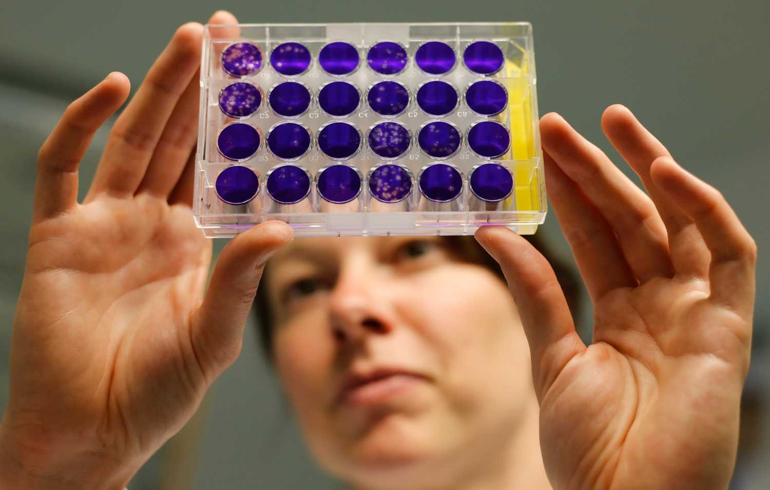 Dr. Doreen Muth from the virology institute of the Bonn Faculty of Medicine looks at a 24-way plague assay of viruses culture plates in the western German city of Bonn May 31, 2013. The virology institute of the Bonn university researches on viruses with the help of bat and human cell culture models and reverse genetic systems for corona viruses (SARS-Coronavirus, HCoV-NL63) to characterize and compare the functions of homologous viral proteins from newly identified viruses. Picture taken May 31, 2013.   REUTERS/Wolfgang Rattay    (GERMANY - Tags: SCIENCE TECHNOLOGY HEALTH) - BM2E97H0ZK401