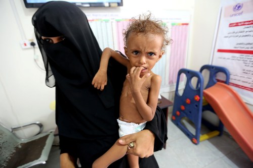 Mother of malnourished Ferial Elias, 2, holds her at a malnutrition treatment ward at al-Thawra hospital in Hodeidah, Yemen November 3, 2018. Picture taken November 3, 2018. REUTERS/Abduljabbar Zeyad - RC17BB71C320