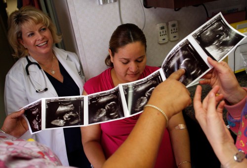 Nurse practitioner Gail Brown (L) an unidentified patient and other nurses look at a print out of an ultrasound from a prenatal exam at the Maternity Outreach Mobile in Phoenix, Arizona October 8, 2009. The maternity outreach program helps uninsured women living in the Phoenix metropolitan area receive the proper treatment and care during and after their pregnancy. The Maternity Outreach Mobile is equipped with two exam rooms, an ultrasound machine, an external fetal monitor, a laboratory and offers pregnancy tests, referrals and immunization for children. REUTERS/Joshua Lott (UNITED STATES - Tags: HEALTH SOCIETY) - WASE5A91J3I01