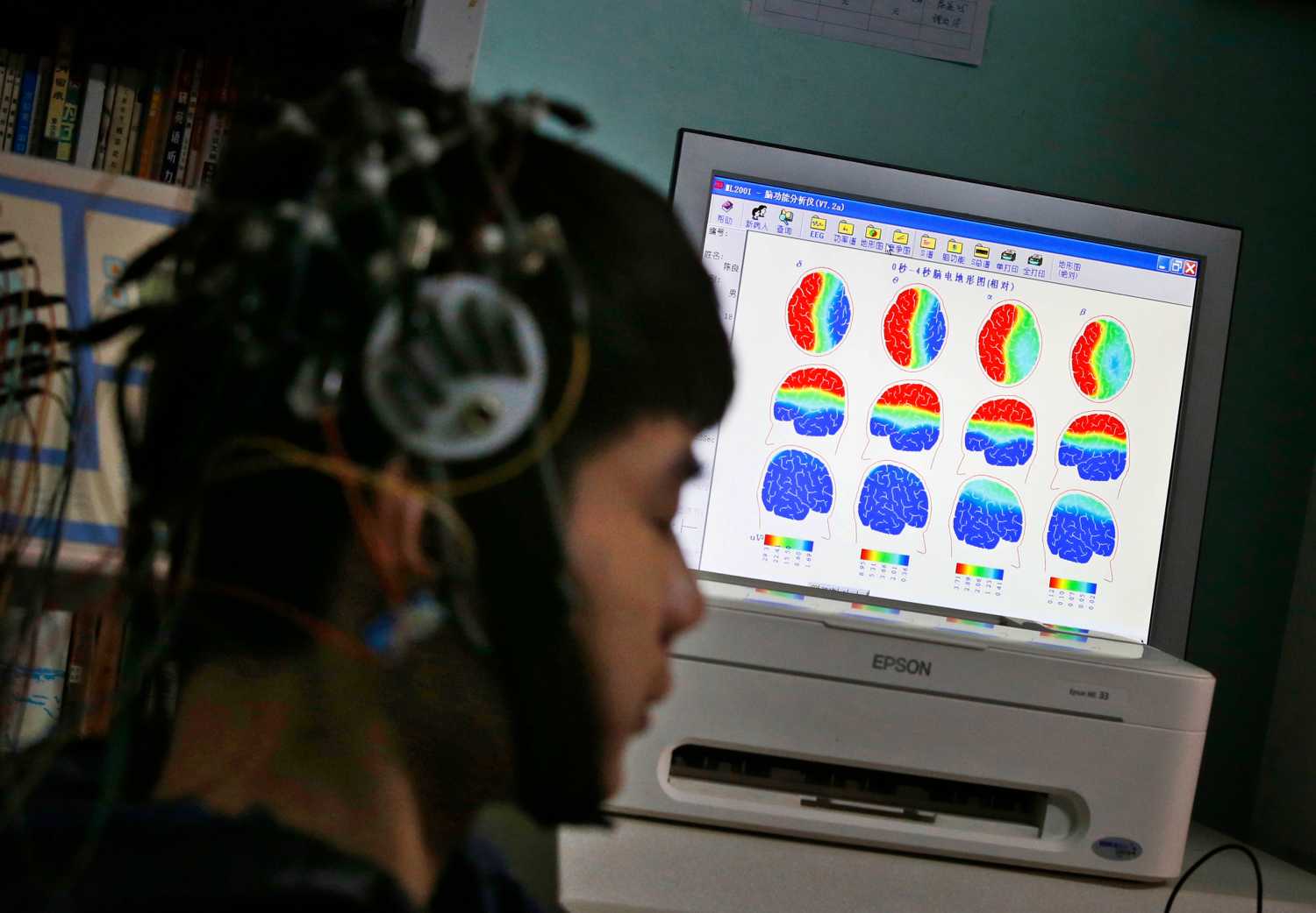 A boy who was addicted to the internet, has his brain scanned for research purposes at Daxing Internet Addiction Treatment Center in Beijing February 22, 2014. As growing numbers of young people in China immerse themselves in the cyber world, spending hours playing games online, worried parents are increasingly turning to boot camps to crush addiction. Military-style boot camps, designed to wean young people off their addiction to the internet, number as many as 250 in China alone. Picture taken February 22, 2014. REUTERS/Kim Kyung-Hoon (CHINA - Tags: SOCIETY)ATTENTION EDITORS - PICTURE 20 OF 33 FOR PACKAGE 'CURING CHINA'S INTERNET ADDICTS'TO FIND ALL IMAGES SEARCH 'INTERNET BOOT CAMP'