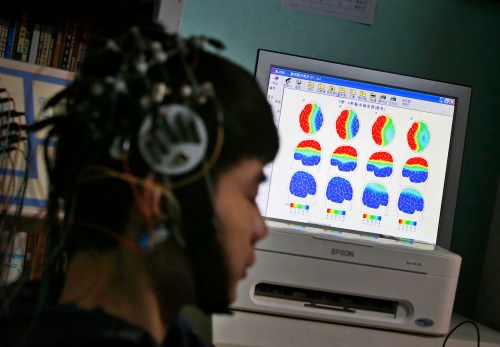 A boy who was addicted to the internet, has his brain scanned for research purposes at Daxing Internet Addiction Treatment Center in Beijing February 22, 2014. As growing numbers of young people in China immerse themselves in the cyber world, spending hours playing games online, worried parents are increasingly turning to boot camps to crush addiction. Military-style boot camps, designed to wean young people off their addiction to the internet, number as many as 250 in China alone. Picture taken February 22, 2014. REUTERS/Kim Kyung-Hoon (CHINA - Tags: SOCIETY)ATTENTION EDITORS - PICTURE 20 OF 33 FOR PACKAGE 'CURING CHINA'S INTERNET ADDICTS'TO FIND ALL IMAGES SEARCH 'INTERNET BOOT CAMP'