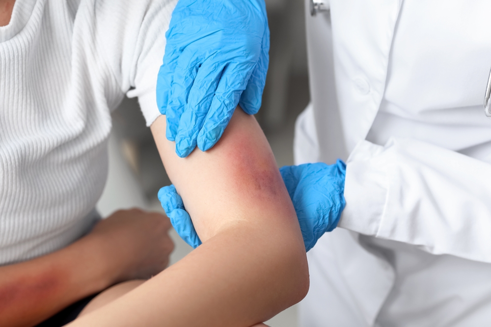 Woman having a bruise examined